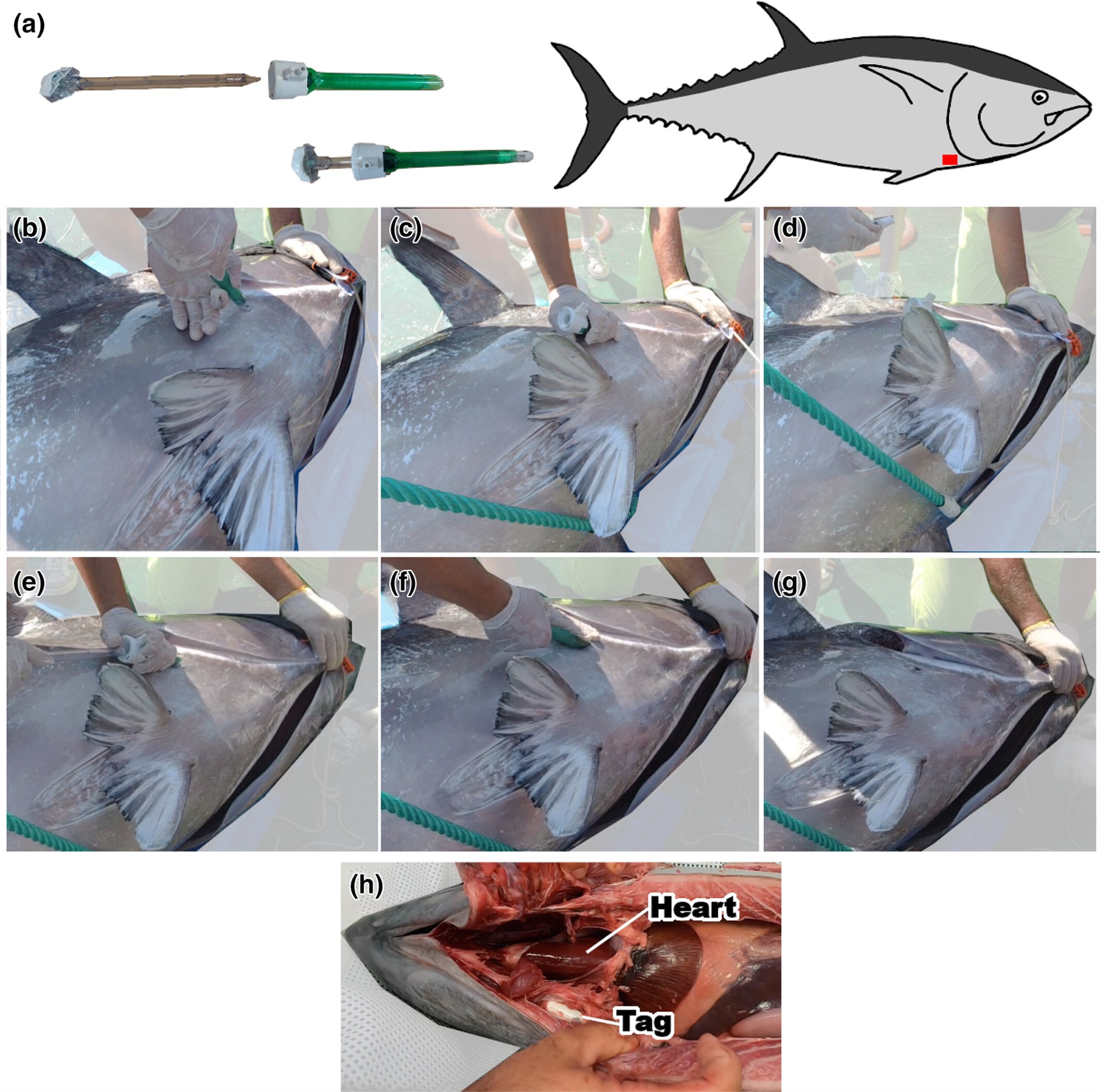 Implantation_procedure